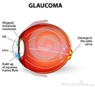 מחלות עיניים - גלאוקומה Glaucoma
